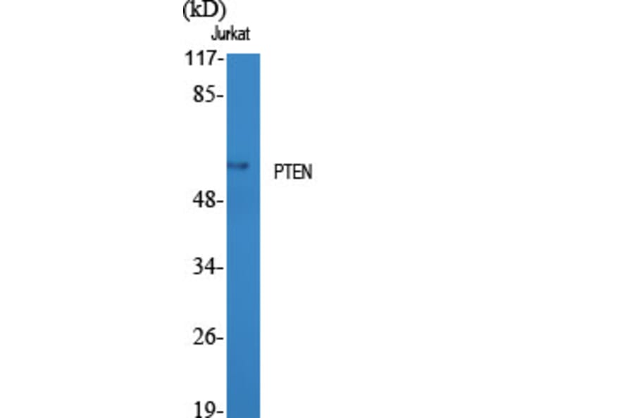 Western blot - PTEN Polyclonal Antibody from Signalway Antibody (41366) - Antibodies.com