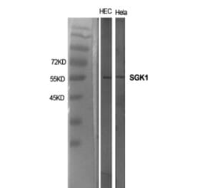 Western blot - SGK1 Polyclonal Antibody from Signalway Antibody (41429) - Antibodies.com