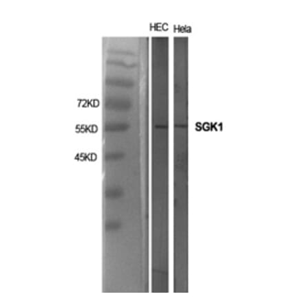 Western blot - SGK1 Polyclonal Antibody from Signalway Antibody (41429) - Antibodies.com