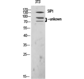 Western blot - SIP1 Polyclonal Antibody from Signalway Antibody (41435) - Antibodies.com