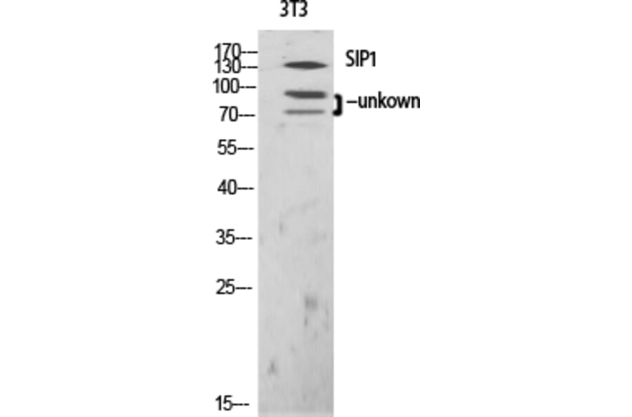 Western blot - SIP1 Polyclonal Antibody from Signalway Antibody (41435) - Antibodies.com