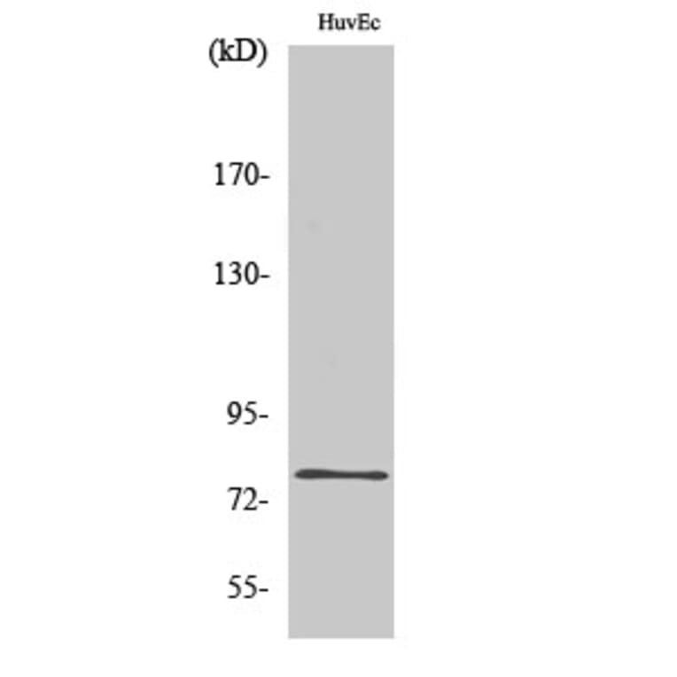 Western blot - SnoN Polyclonal Antibody from Signalway Antibody (41450) - Antibodies.com