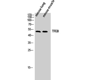 Western blot - TFEB Polyclonal Antibody from Signalway Antibody (41488) - Antibodies.com