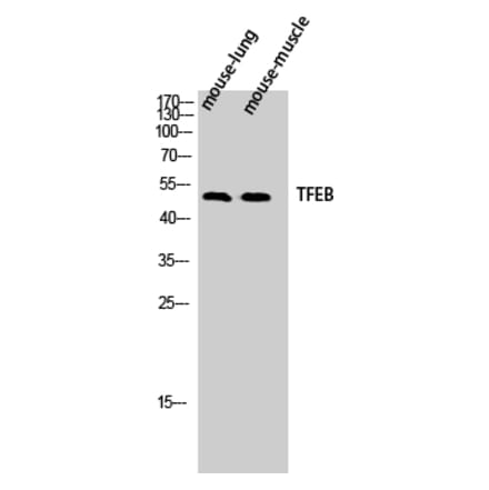 Western blot - TFEB Polyclonal Antibody from Signalway Antibody (41488) - Antibodies.com