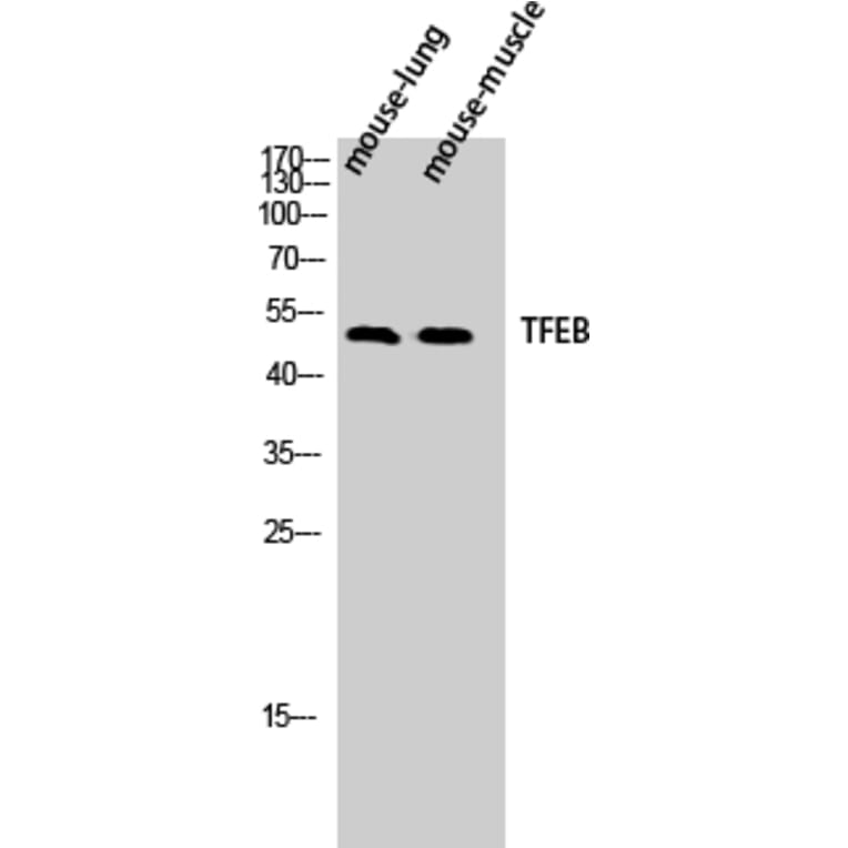 Western blot - TFEB Polyclonal Antibody from Signalway Antibody (41488) - Antibodies.com