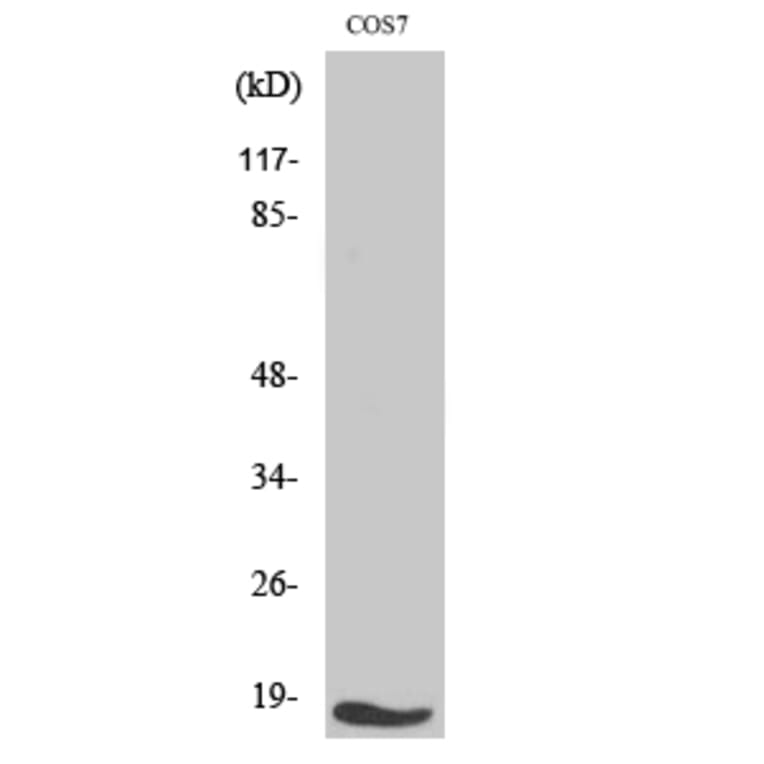Western blot - TGFα Polyclonal Antibody from Signalway Antibody (41490) - Antibodies.com