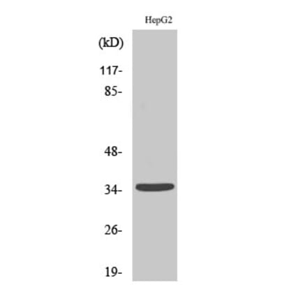Western blot - Ubr1 Polyclonal Antibody from Signalway Antibody (41521) - Antibodies.com