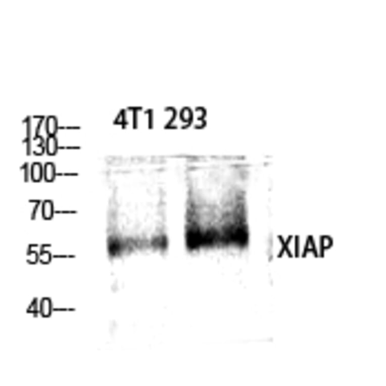 Western blot - XIAP Polyclonal Antibody from Signalway Antibody (41536) - Antibodies.com