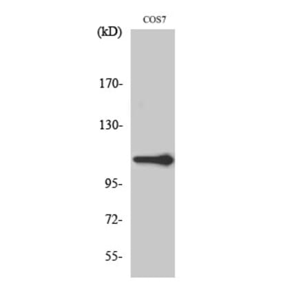 Western blot - XRN2 Polyclonal Antibody from Signalway Antibody (41539) - Antibodies.com