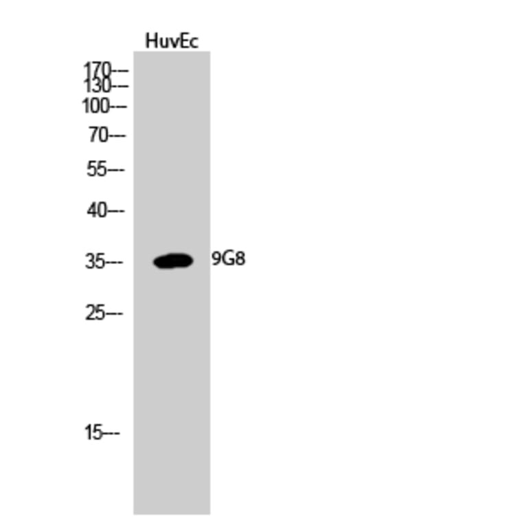 Western blot - 9G8 Polyclonal Antibody from Signalway Antibody (40529) - Antibodies.com