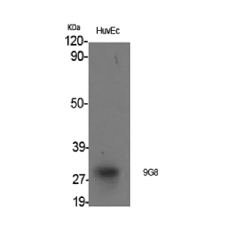 Western blot - 9G8 Polyclonal Antibody from Signalway Antibody (40529) - Antibodies.com