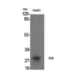 Western blot - 9G8 Polyclonal Antibody from Signalway Antibody (40529) - Antibodies.com