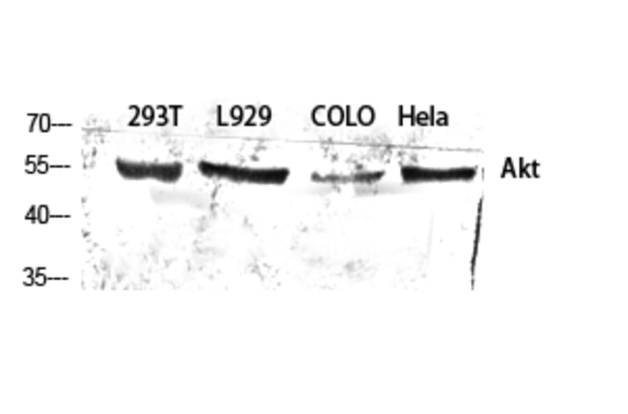 Western blot - Akt Polyclonal Antibody from Signalway Antibody (40576) - Antibodies.com