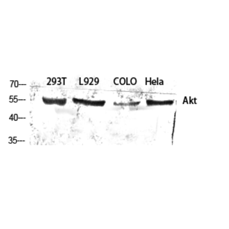 Western blot - Akt Polyclonal Antibody from Signalway Antibody (40576) - Antibodies.com