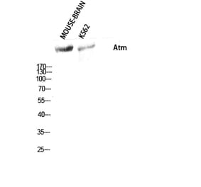 Western blot - Atm Polyclonal Antibody from Signalway Antibody (40627) - Antibodies.com