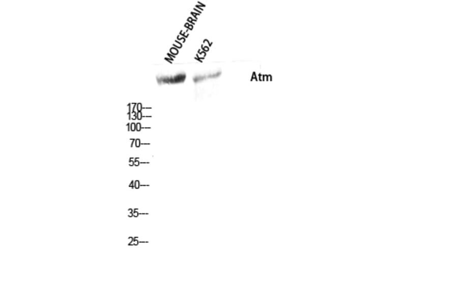 Western blot - Atm Polyclonal Antibody from Signalway Antibody (40627) - Antibodies.com