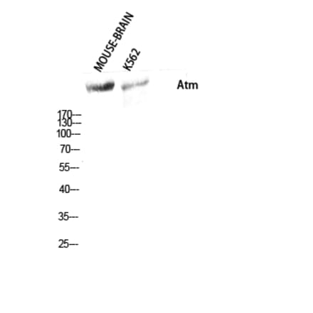 Western blot - Atm Polyclonal Antibody from Signalway Antibody (40627) - Antibodies.com