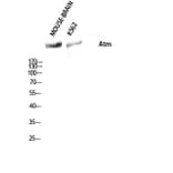 Western blot - Atm Polyclonal Antibody from Signalway Antibody (40627) - Antibodies.com