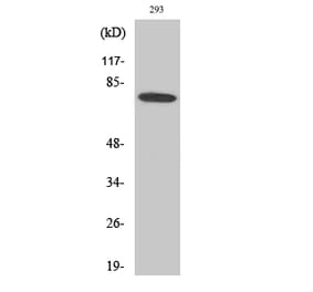 Western blot - Btk Polyclonal Antibody from Signalway Antibody (40656) - Antibodies.com