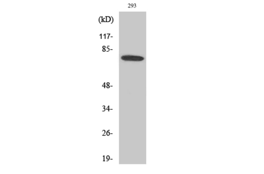 Western blot - Btk Polyclonal Antibody from Signalway Antibody (40656) - Antibodies.com