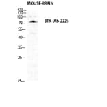 Western blot - Btk Polyclonal Antibody from Signalway Antibody (40656) - Antibodies.com