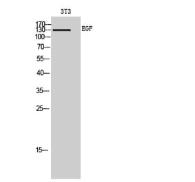 Western blot - EGF Polyclonal Antibody from Signalway Antibody (40865) - Antibodies.com
