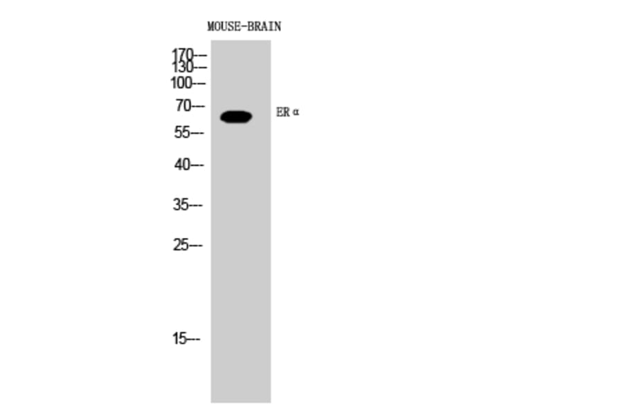 Western blot - ERα Polyclonal Antibody from Signalway Antibody (40906) - Antibodies.com