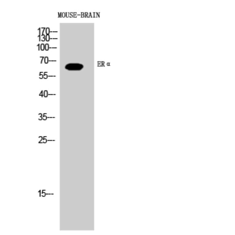 Western blot - ERα Polyclonal Antibody from Signalway Antibody (40906) - Antibodies.com