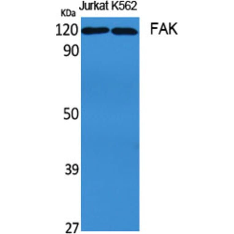 Western blot - FAK Polyclonal Antibody from Signalway Antibody (40914) - Antibodies.com