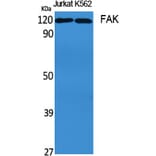 Western blot - FAK Polyclonal Antibody from Signalway Antibody (40914) - Antibodies.com