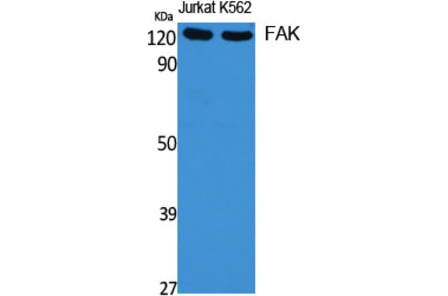 Western blot - FAK Polyclonal Antibody from Signalway Antibody (40916) - Antibodies.com