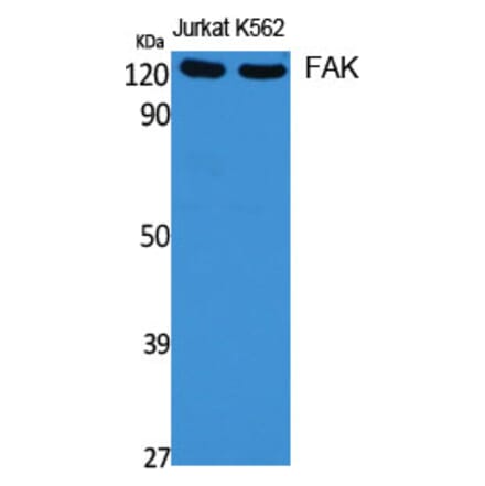 Western blot - FAK Polyclonal Antibody from Signalway Antibody (40916) - Antibodies.com