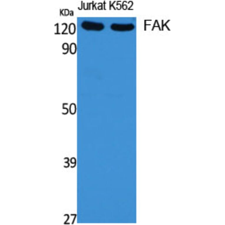Western blot - FAK Polyclonal Antibody from Signalway Antibody (40916) - Antibodies.com