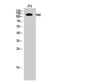 Western blot - FAK Polyclonal Antibody from Signalway Antibody (40918) - Antibodies.com