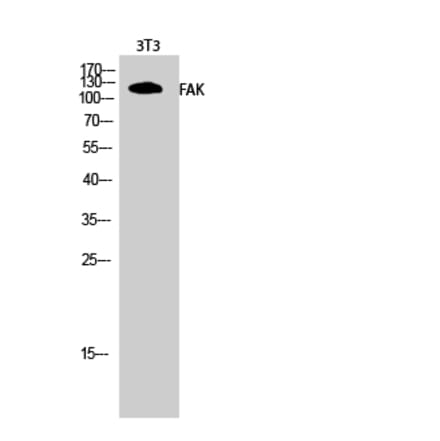 Western blot - FAK Polyclonal Antibody from Signalway Antibody (40918) - Antibodies.com