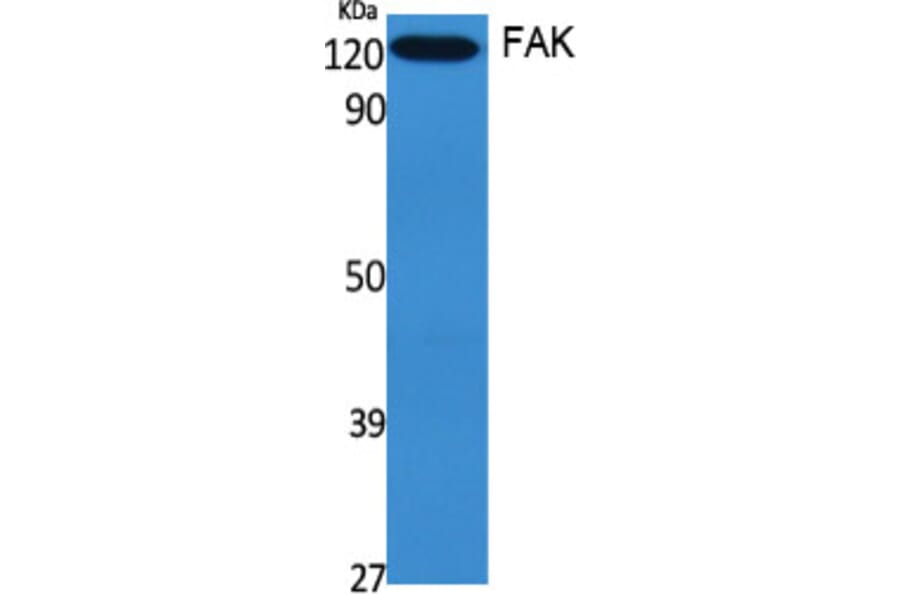 Western blot - FAK Polyclonal Antibody from Signalway Antibody (40918) - Antibodies.com