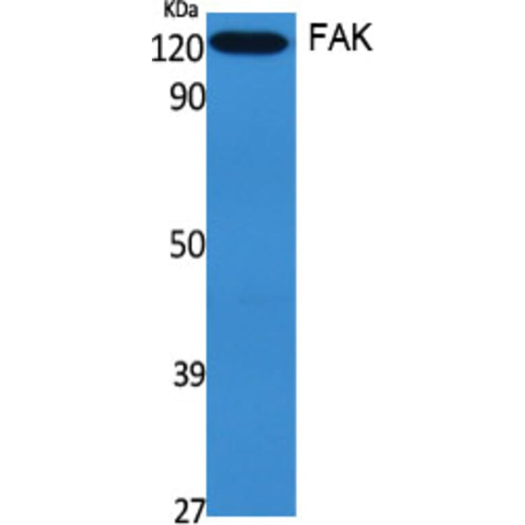 Western blot - FAK Polyclonal Antibody from Signalway Antibody (40918) - Antibodies.com
