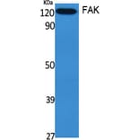 Western blot - FAK Polyclonal Antibody from Signalway Antibody (40918) - Antibodies.com