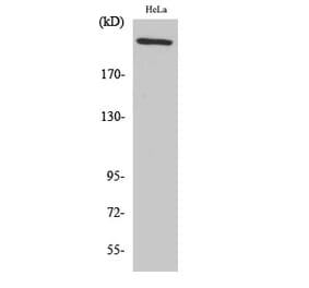 Western blot - FN1 Polyclonal Antibody from Signalway Antibody (40932) - Antibodies.com