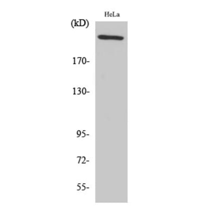 Western blot - FN1 Polyclonal Antibody from Signalway Antibody (40932) - Antibodies.com