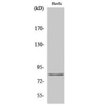 Western blot - HSL Polyclonal Antibody from Signalway Antibody (41039) - Antibodies.com