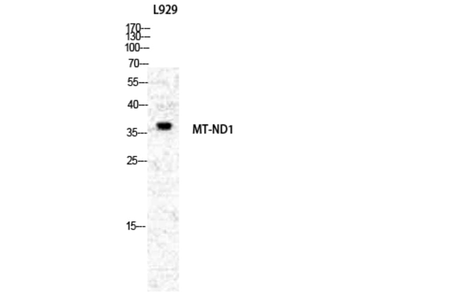 Western blot - ND1 Polyclonal Antibody from Signalway Antibody (41203) - Antibodies.com