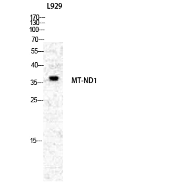Western blot - ND1 Polyclonal Antibody from Signalway Antibody (41203) - Antibodies.com