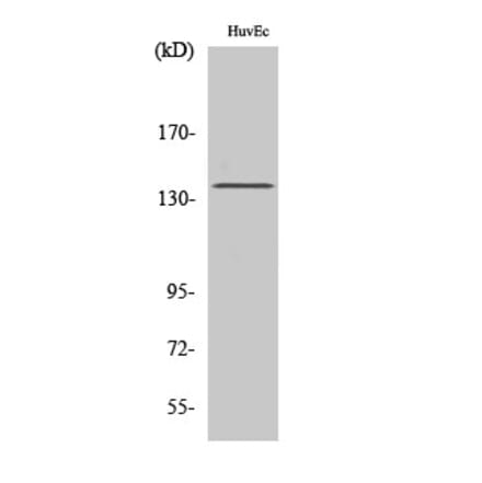 Western blot - Neu Polyclonal Antibody from Signalway Antibody (41217) - Antibodies.com