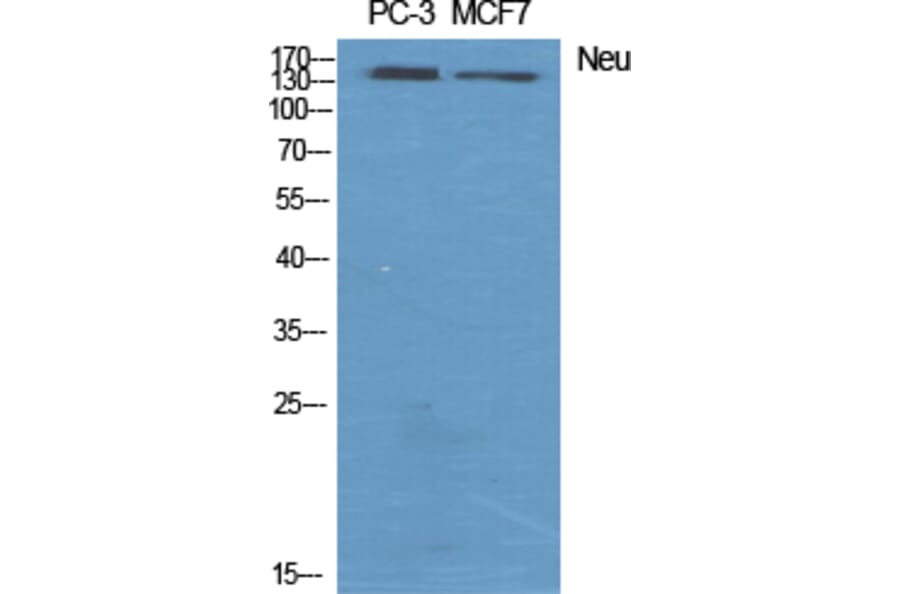 Western blot - Neu Polyclonal Antibody from Signalway Antibody (41217) - Antibodies.com
