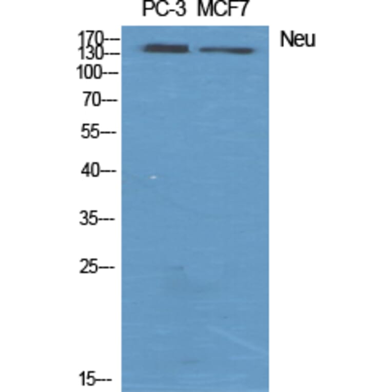 Western blot - Neu Polyclonal Antibody from Signalway Antibody (41217) - Antibodies.com