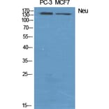 Western blot - Neu Polyclonal Antibody from Signalway Antibody (41217) - Antibodies.com