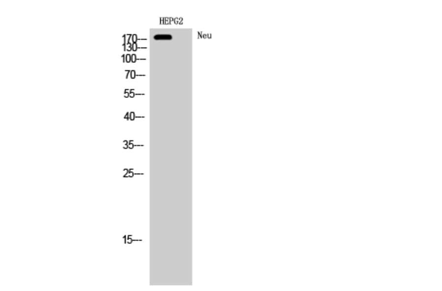 Western blot - Neu Polyclonal Antibody from Signalway Antibody (41218) - Antibodies.com