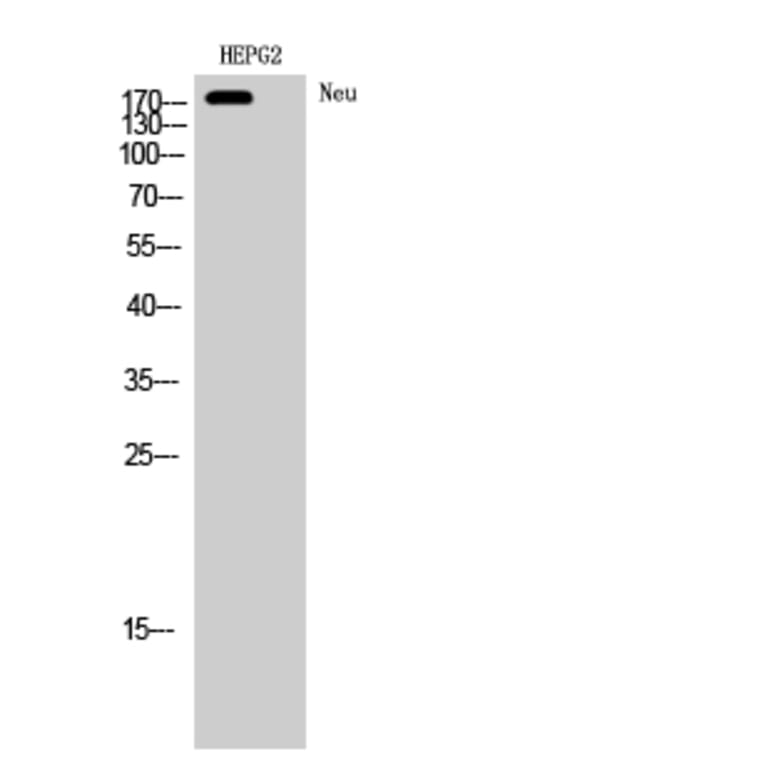 Western blot - Neu Polyclonal Antibody from Signalway Antibody (41218) - Antibodies.com