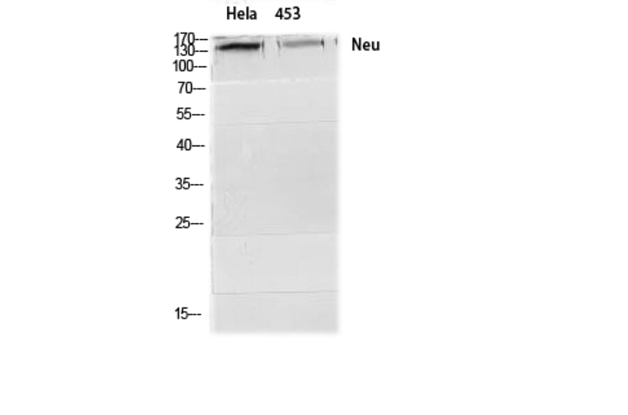 Western blot - Neu Polyclonal Antibody from Signalway Antibody (41218) - Antibodies.com
